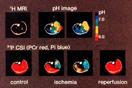 細胞内ｐＨの画像化